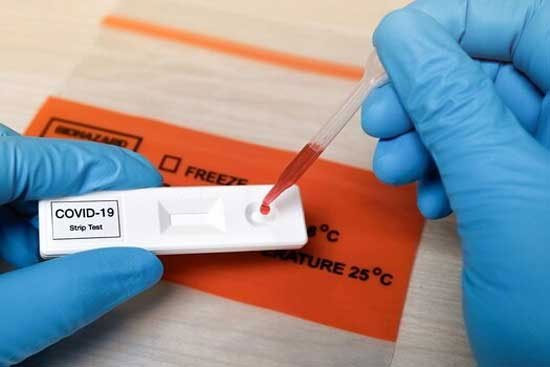 Covid-19 test made mandatory in Karnataka amid rising cases